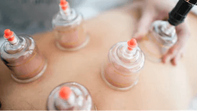 Image for 90 Minute Cupping Therapy