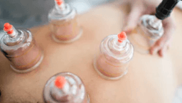 Image for 45 Minute Cupping Therapy
